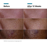 C E Ferulic® with 15% L-Ascorbic Acid