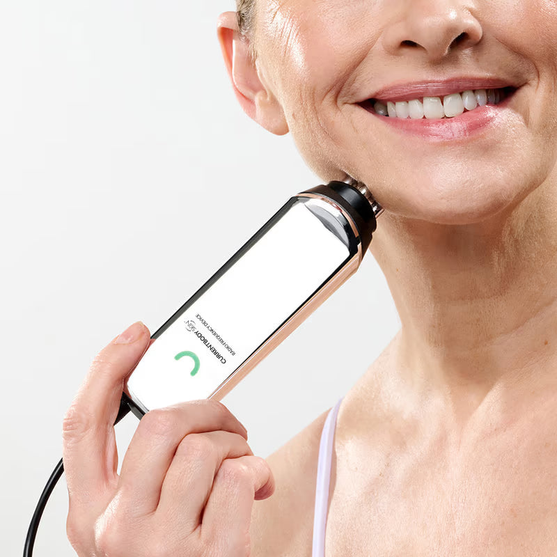 RF Microneedling Treatment